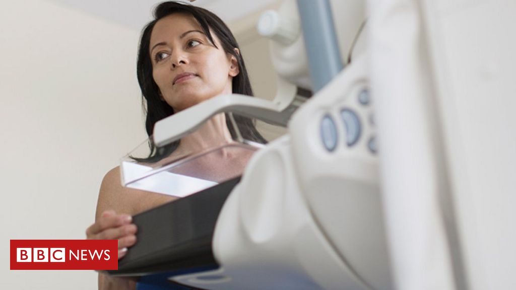 Breast Screening One Million Women In Uk May Have Missed Scans